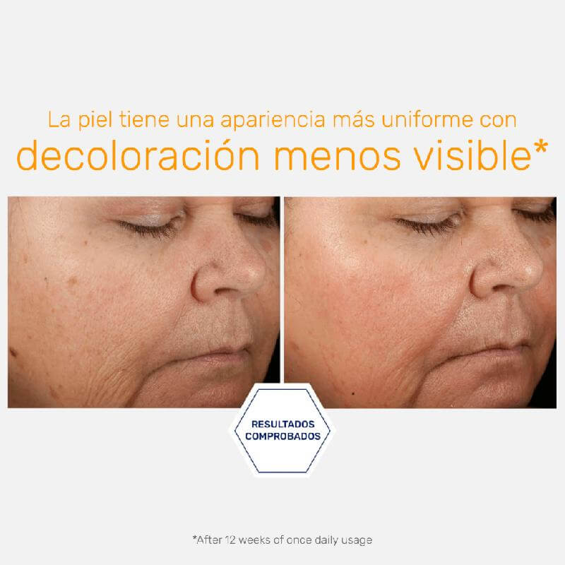 Serum 15% Vitamin C+ PHA - Serum Antioxidante Despigmentante Uso AM